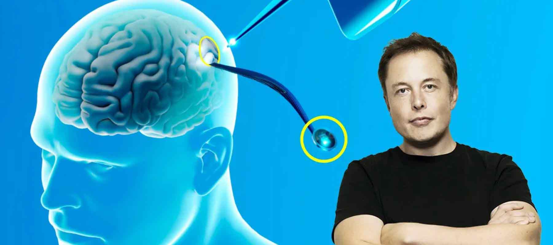 Neuralink-logra-exitosamente-el-primer-implante-de-chip-cerebral-en-un-ser-humano